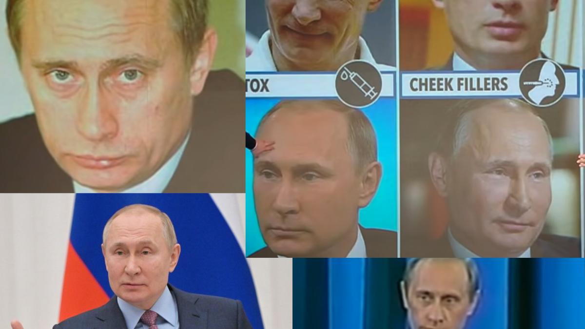 adevaratul-putin--dat-de-gol-de-operatiile-estetice--medicii-rup-tacerea--ce-si-cate-are-e-clar--nu-mai-e-acelasi_07708100