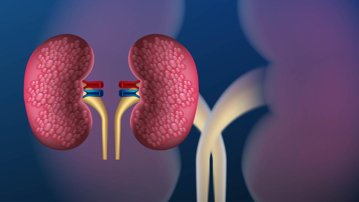 actualitati-in-transplantul-renal--cu-prof--dr--adrian-covic--la-academia-de-sanatate_97808200