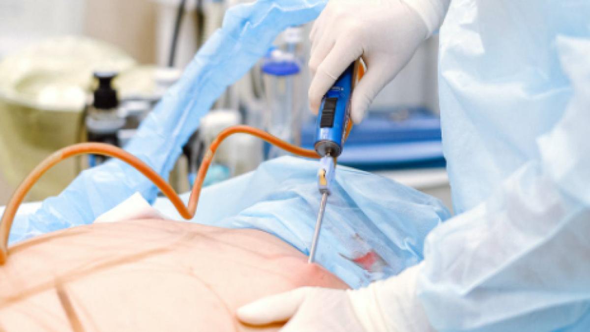 chirurgia-laparoscopica--patru-avantaje-importante--dr--horia-cioflan-cu-cat-e-taietura-mai-mica--cu-atat-durerea-e-mai-mica_71449500