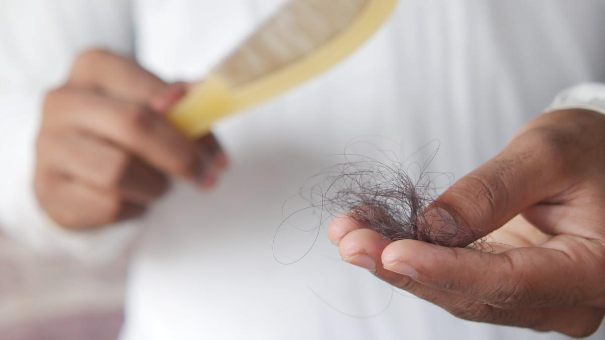 alopecia--foto-pexels--at--towfiqu-barbhuiya_08696800