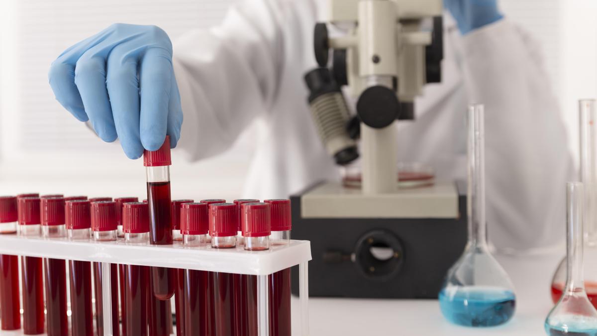 icterul-si-hepatita-misterioasa--cauze-si-simptome--semnele-la-care-sa-fii-atent--trebuie-sa-stii-sa-le-recunosti_56391500