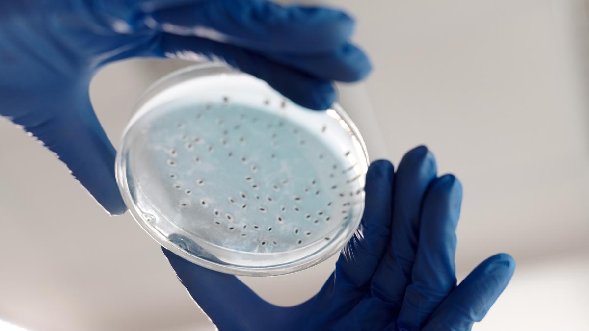 probioticele_25194100