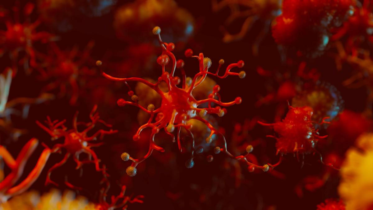 car-t-sau-terapiile-celulare--singura-sansa-a-pacientilor-cu-leucemie--realitate-in-romania--dr--tanase-un-vis-al-oricarui-oncolog--sa-distruga-cancerul_59028100