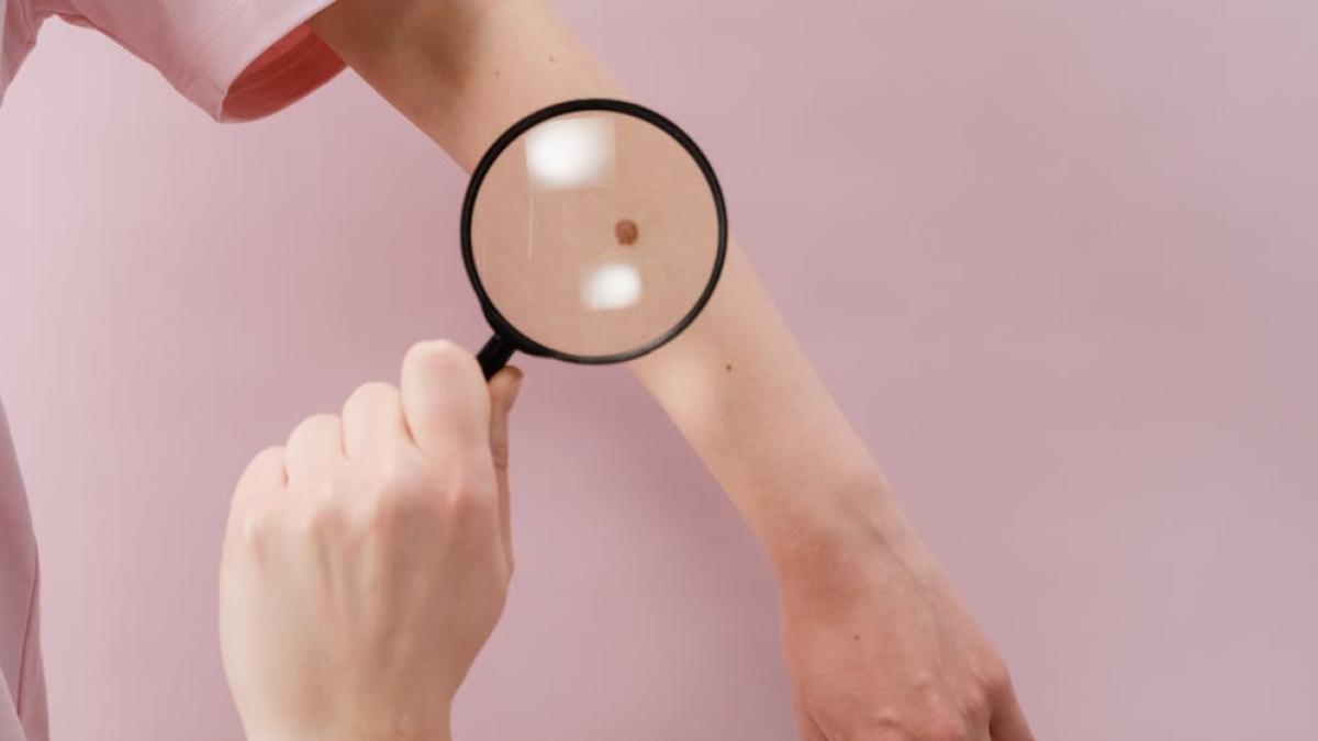 abc-ul-evaluarii-dermatologice--foto-pexels--at--cottonbro_13725500