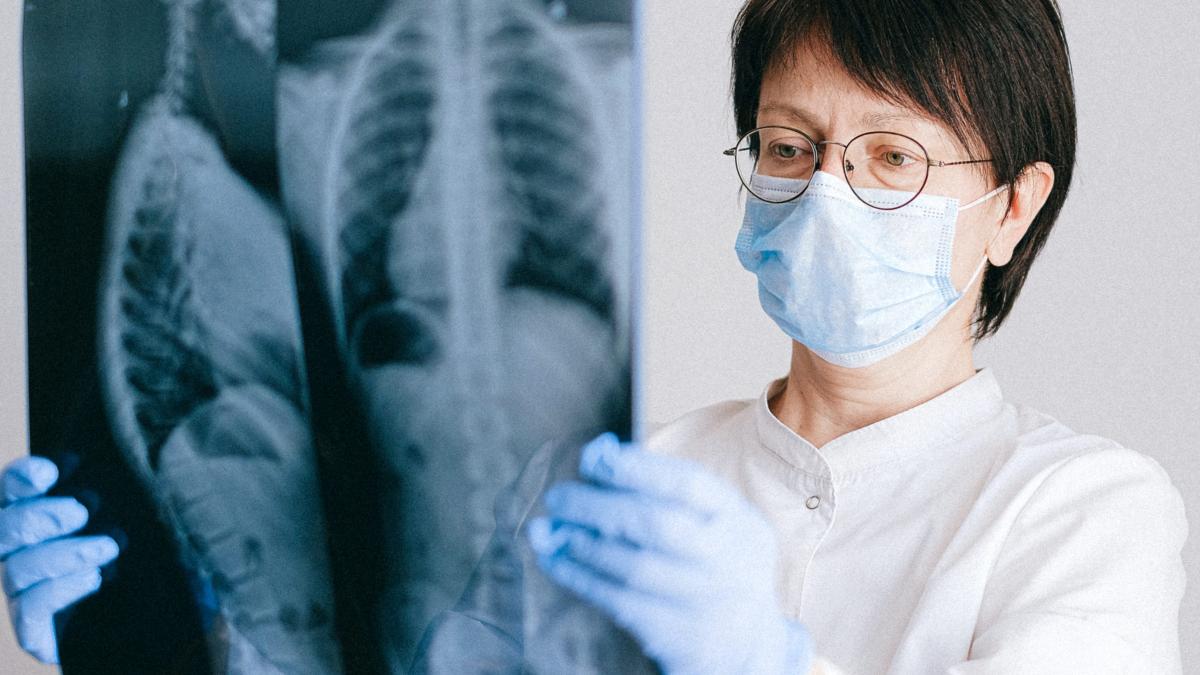 transplantul-pulmonar_69126100