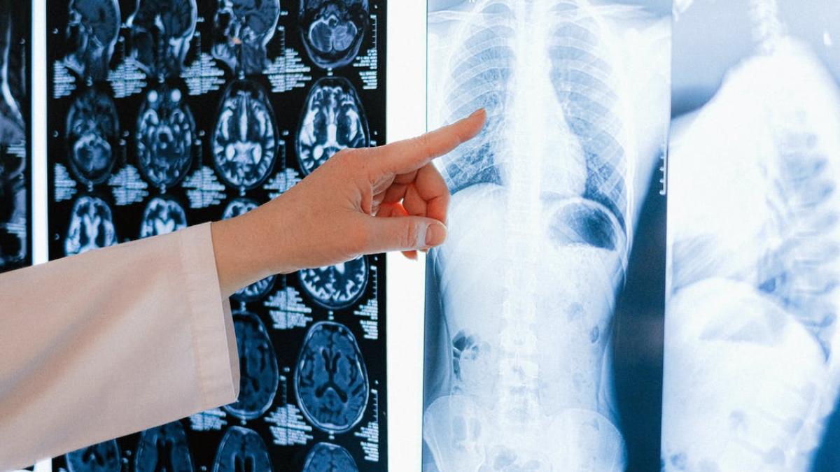neurotrauma-treatment-simulation-center--foto-pexels--at--anna-shvets_99602000
