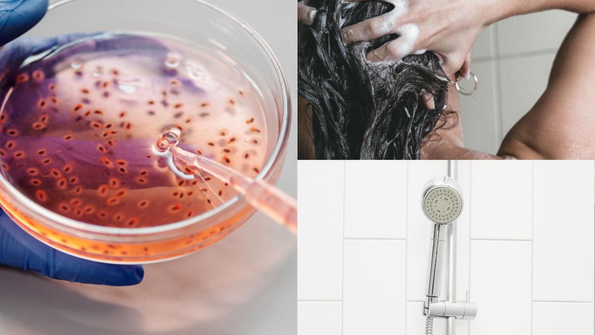 legionella--bacteria-mortala-pe-care-o-poti-lua-in-timpul-unui-dus--la-hotel--la-ce-sa-fii-atent-cand-ajungi-la-cazare--alerta-in-grecia_50533700