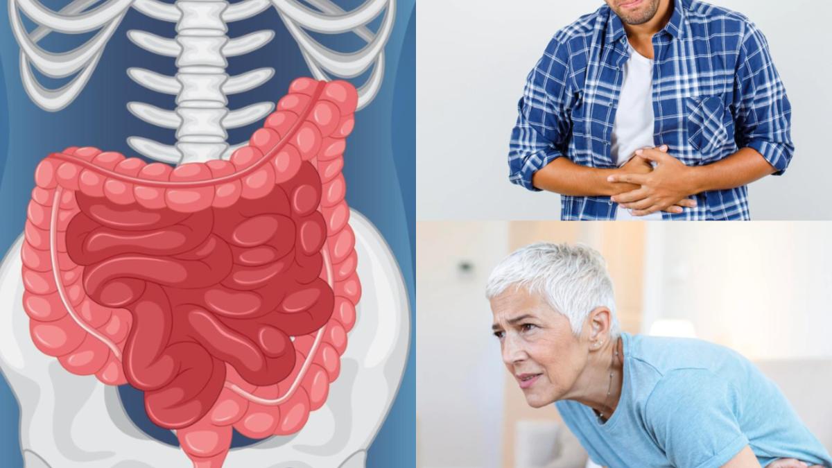 boala-inflamatorie-intestinala--_boala-civilizatiei-de-azi_--negreanu_-pacienti-infectati-voit-cu-oua-de-tenie--dovezi-interesante_05999100