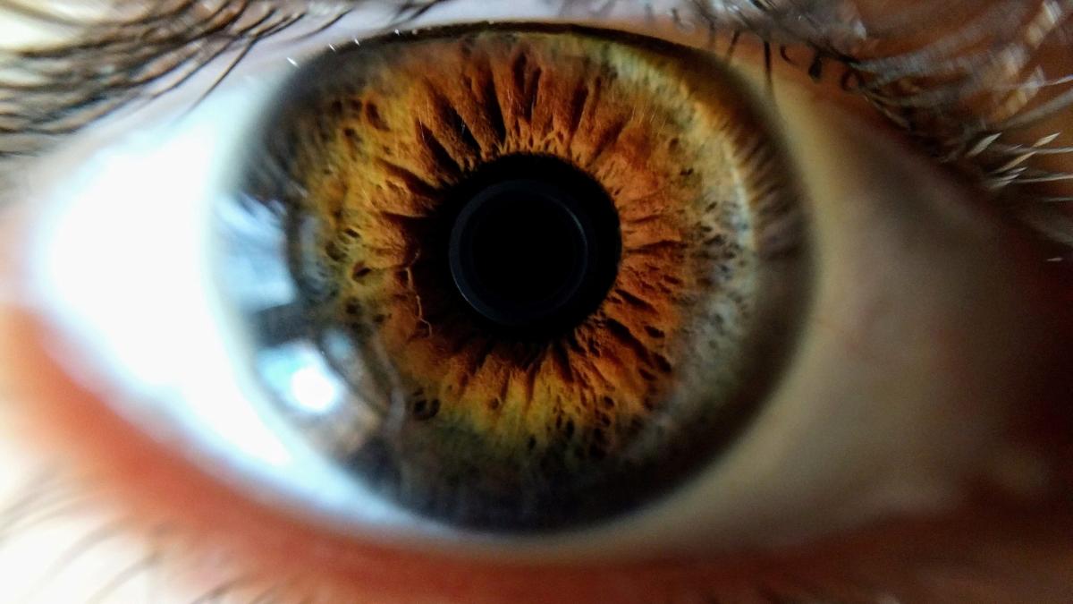 glaucomul_70449200