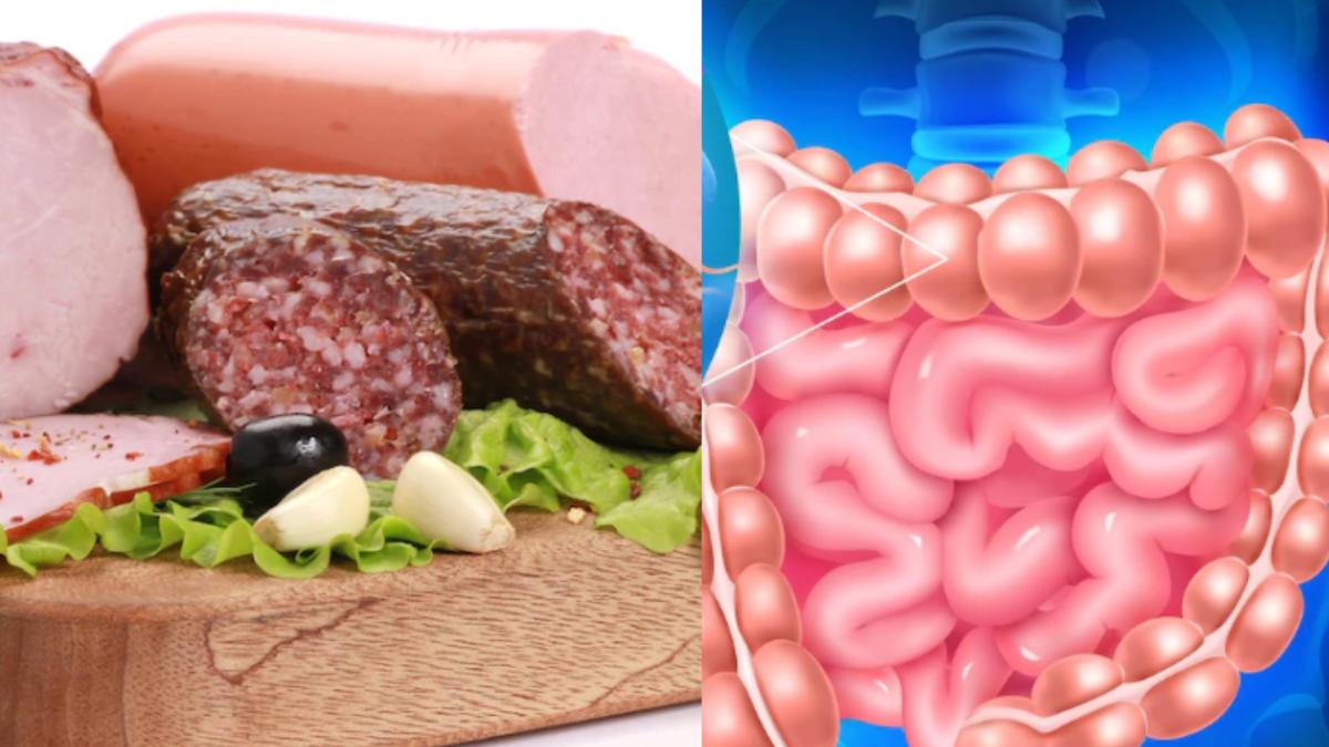 cine-e-pacientul-care-face-cancer-de-colon--dr--radu_-carnea-rosie-si-mezelurile--vinocate--nu-apare-brusc-si-poate-fi-tratat_31657900