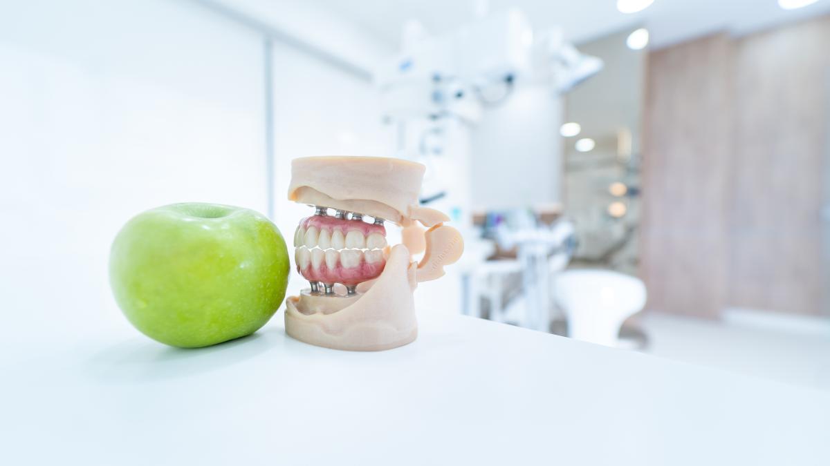 iata-cum-iti-poti-schimba-dantura-si-viata-cu-ajutorul-implanturilor-dentare-p_39259000