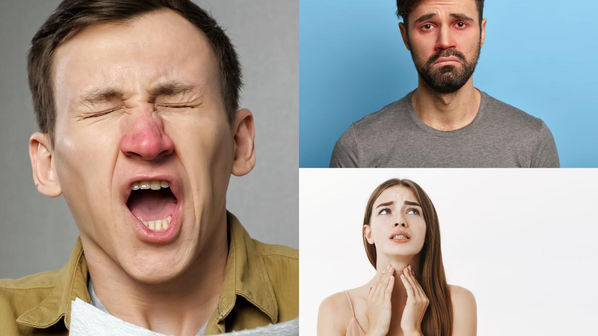 alergia-ciudata-descoperita-la-romani--carmen-bunu-panaitescu-cine-ar-fi-crezut-noi-nu-suntem-obisnuiti--nu-e-normal_28523000