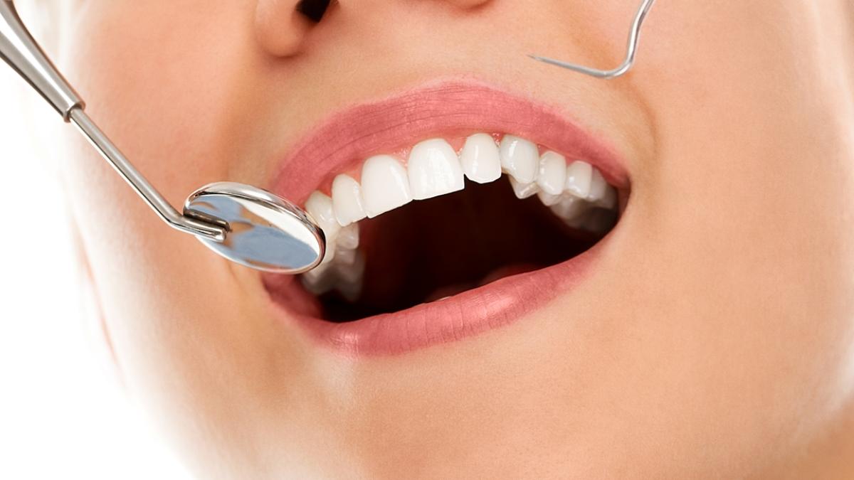 scoaterea-nervului-dintelui--tratamentul-endodontic--ce-trebuie-sa-stii_60899400
