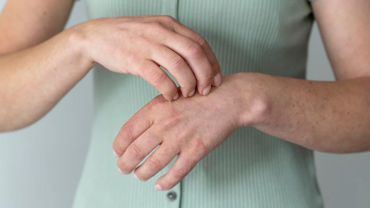 varicela-si-herpesul--factori-de-risc-pentru-alzheimer--medic-pot-duce-la-neuroinflamare_09423400