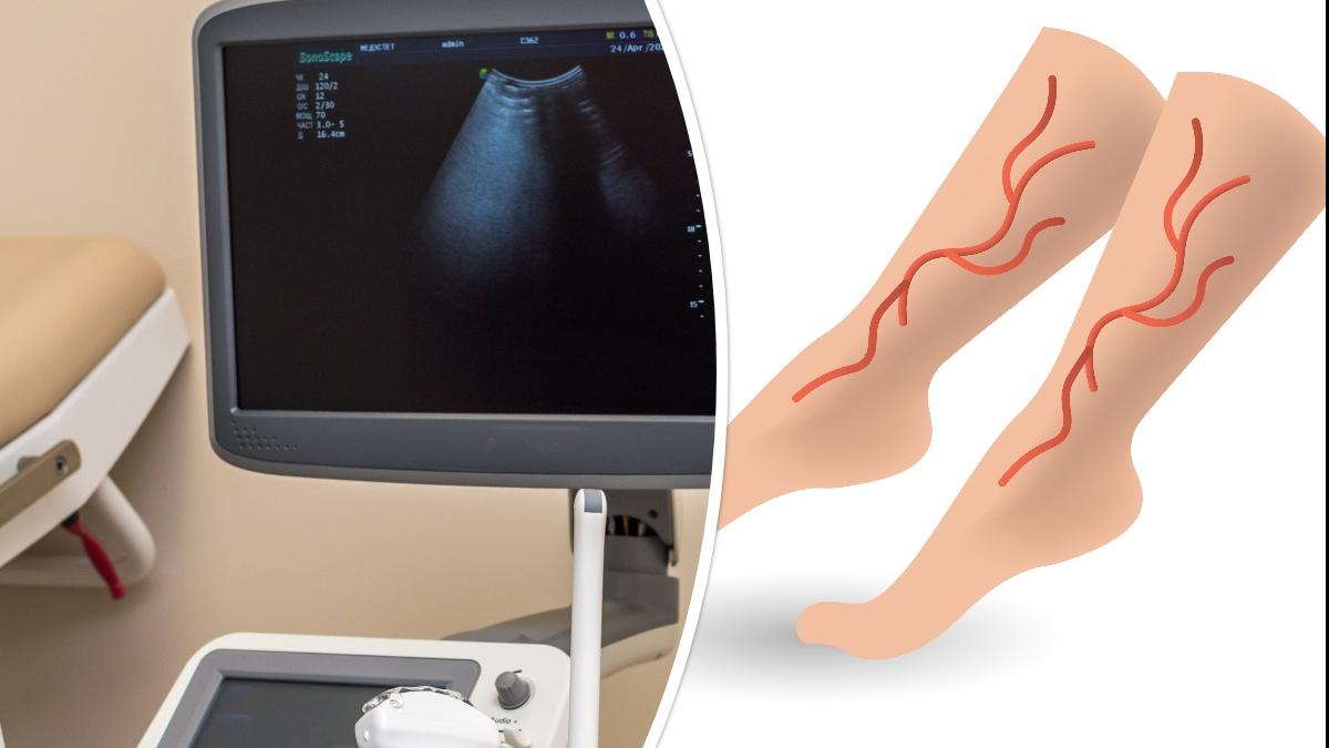 ecografia-vasculara-doppler--procedura-non-invaziva-asupra-vaselor-de-sange_06874700
