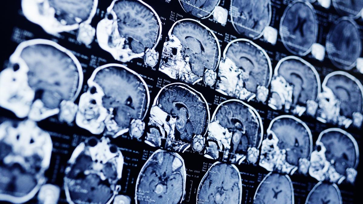 care-este-legatura-dintre-sanatatea-inimii-si-varsta-creierului--femeile--mai-tinere-decat-barbatii_89864200
