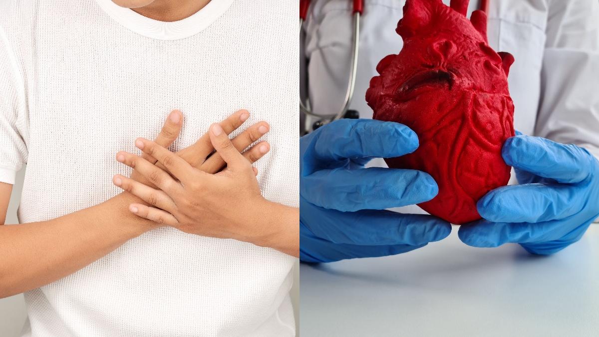 angina-pectorala--senzatia-de-gheara-in-piept--cauze-si-tratament_98660200