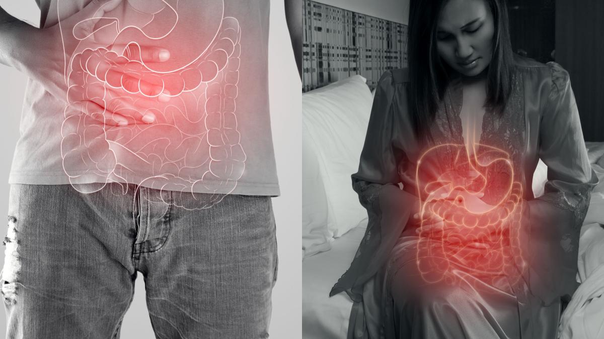 sindromul-colonului-iritabil--14-alimente-care-l-provoaca--pe-unele-le-mananci-zilnic--dar-habar-nu-aveai_-poti-face-si-cancer-si-tensiune-arteriala_49402900