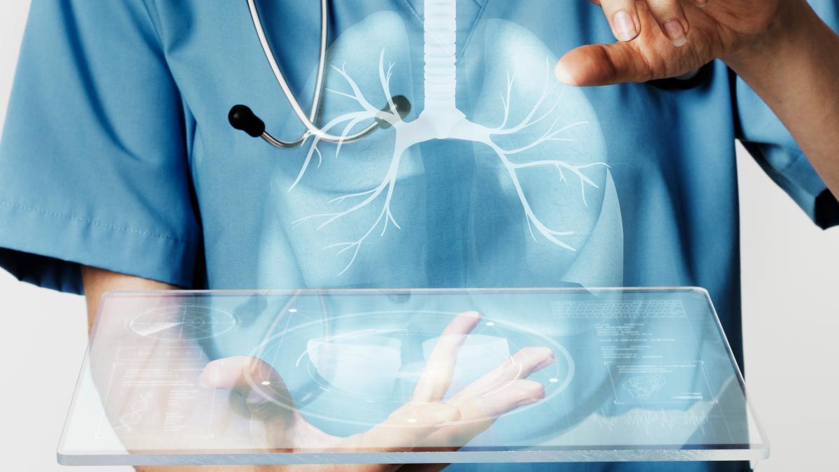 tratamentul-de-succes-pentru-cancerul-pulmonar-un-lucru-fascinant-pentru-pacienti--metastazele-sunt-distruse_38282400
