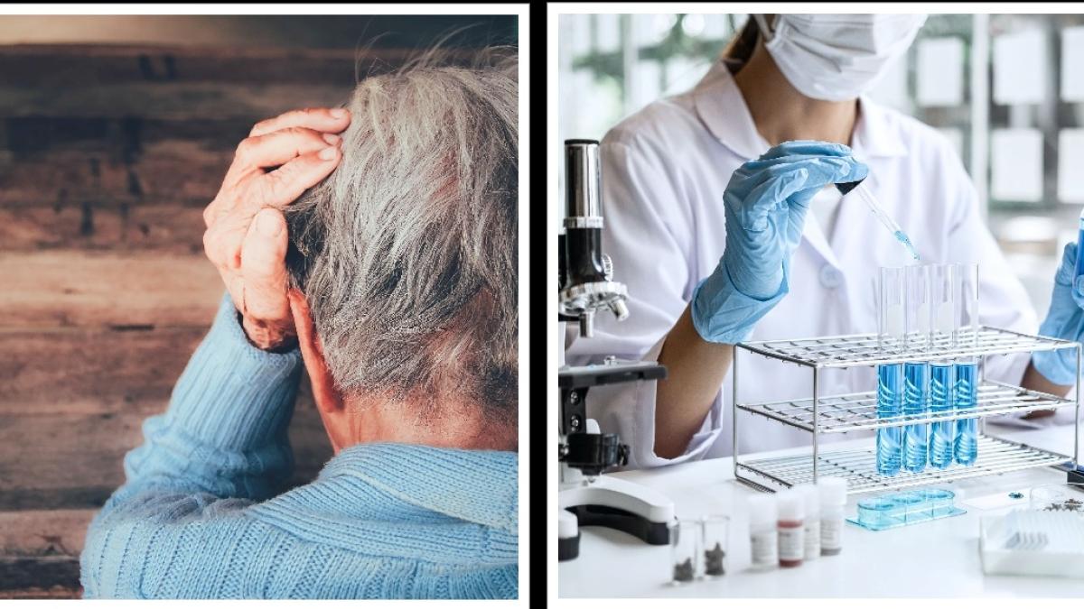 alzheimer--diagnostic-prin-analize-de-sange_65655800
