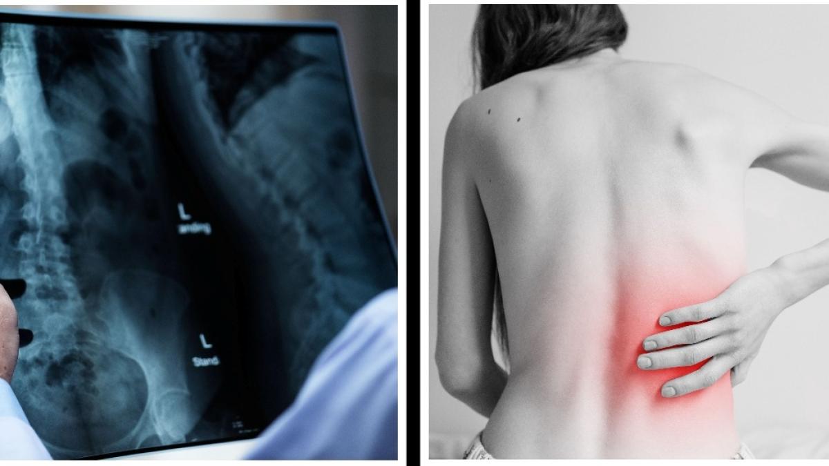 osteoporoza--testul-de-10-minute-care-iti-arata-gradul-de-afectare-al-oaselor_59116700