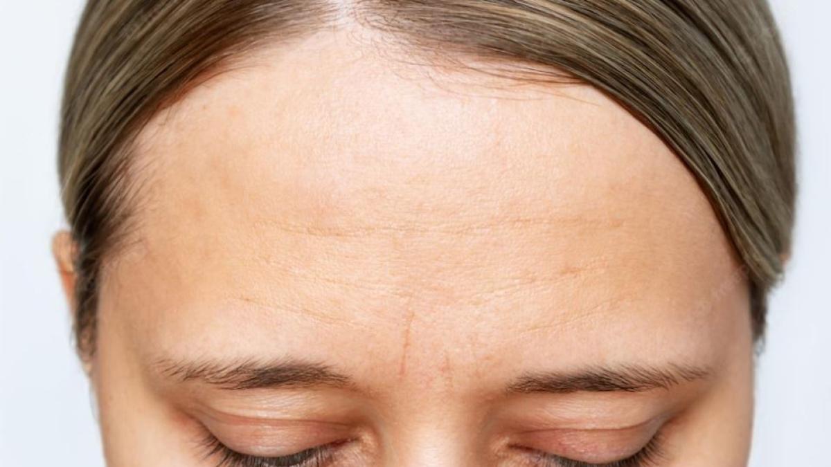 un-produs-alimentar-provoaca-imbatranirea-prematura-a-tenului_55430700