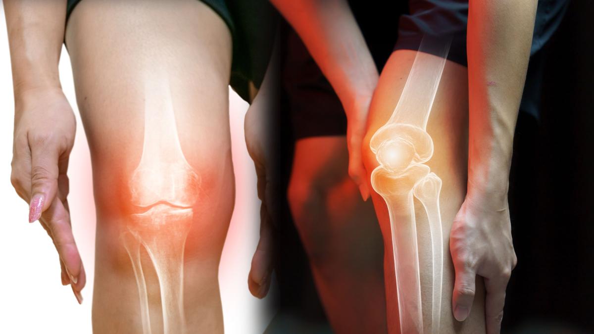 cele-doua-teste-care-iti-arata-daca-ai-osteoporoza--streinu---cercel_-arata-clar-incarcarea-cu-calciu-a-oaselor-si-rezistenta-la-soc-2_13274300