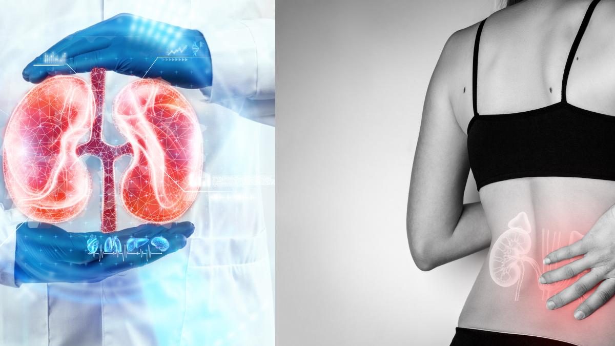 boala-cronica-de-rinichi--cauze--factori-de-risc--complicatii-si-tratament--depistata-tarziu-poate-duce-dializa-sau-transplant-renal_49018600