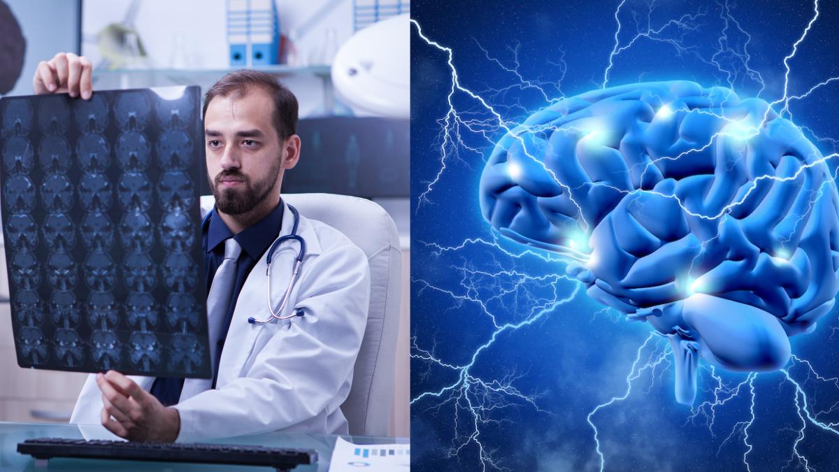 covid-19--impact-asupra-creierului-ca-la-parkinson-si-alzheimer--cercetator-ar-putea-fi-ca-si-cum-s-ar-turna-mai-mult-combustibil-pe-acel-foc-din-creier_45307300