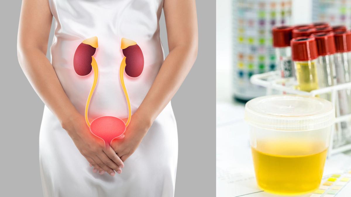 infectiile-urinare--frecvente-in-randul-femeilor--medic-50-60prc--dintre-femei-sufera--pot-avea-si-cauze-emotionale_44188500