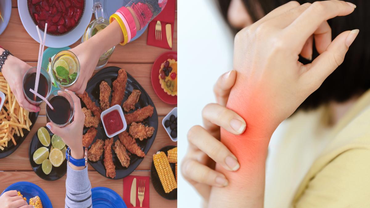 topul-alimentelor-de-evitat-in-cazul-artritei--pot-avea-efecte-si-in-alte-afectiuni_00434200
