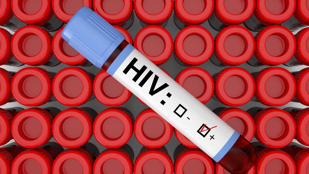 hiv---sida--cauze--simptome--s-a-dublat-numarul-tinerilor-diagnosticati-in-romania--rosu-e-ingrijorator-abia-au-trecut-de-18-ani_72338200
