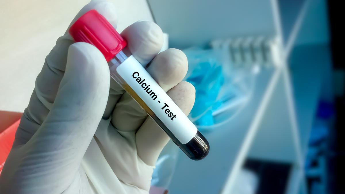 hipercalcemia--cauze--simptome-si-tratament--poate-duce-la-depresie-si-chiar-coma_60640400
