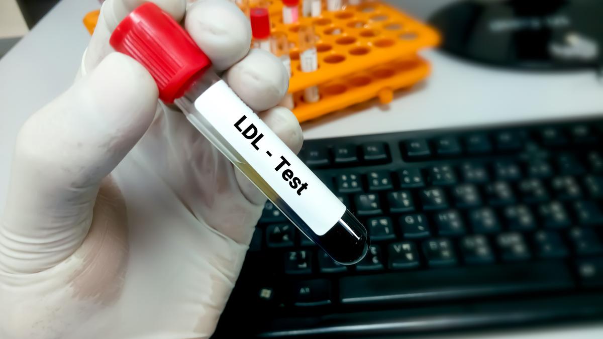 dislipidemia--cauze--factori-de-risc-si-tratament--nica-netratata-duce-la-boli-grave_06972600