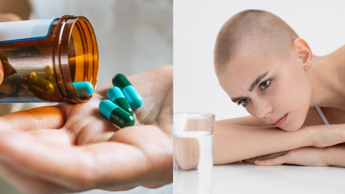 sindromul-anorexie-casiexie--cauze-si-tratament--apare-intre-30-si-80prc--dintre-cazurile-de-cancer_98046100