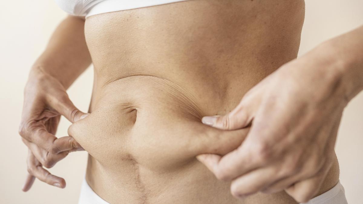unde-se-depune-grasimea-prima-data--de-ce-ne-creste-burta-si-care-e-grasimea-buna--lucrul-nespus-despre-liposuctie-ne-miram-ca-ne-creste-colesterolul_96184800