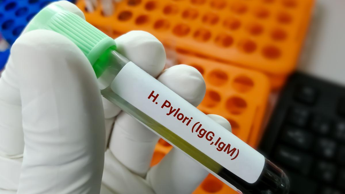 12-lucruri-despre-helicobacter-pylori_12103400