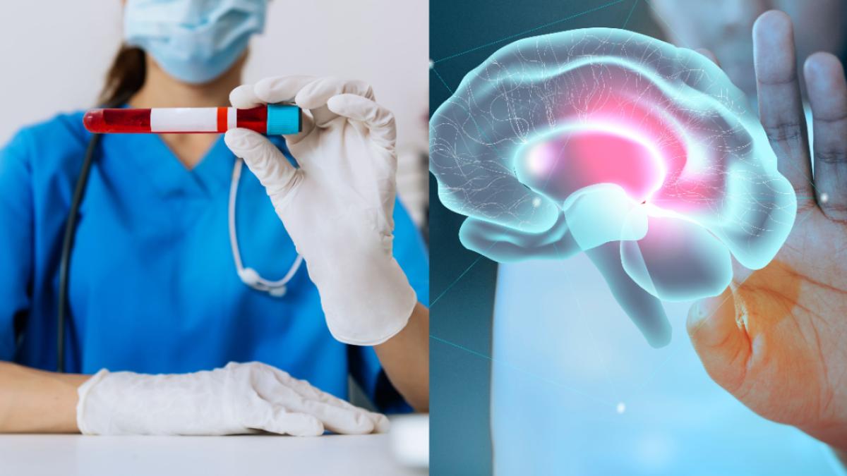 kit-de-diagnosticare-a-bolii-alzheimer--aprobat-spre-vanzare--boala-afecteaza-60-70prc--dintre-cei-cu-dementa_32318000