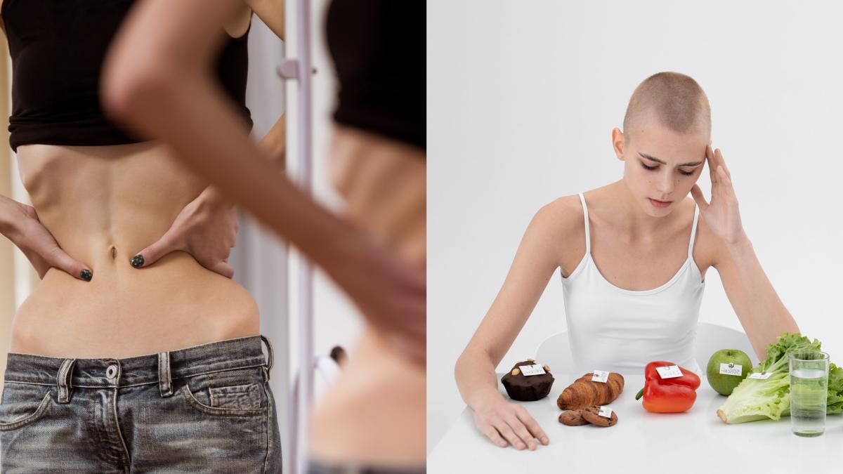 sindromul-de-anorexie-casexie--cancerele-care-afecteaza-pofta-de-mancare--georgescu_-carnea-se-topeste-si-se-transforma-in-apa--tumora-da-o-adevarata-furtuna-metabolica_04921700
