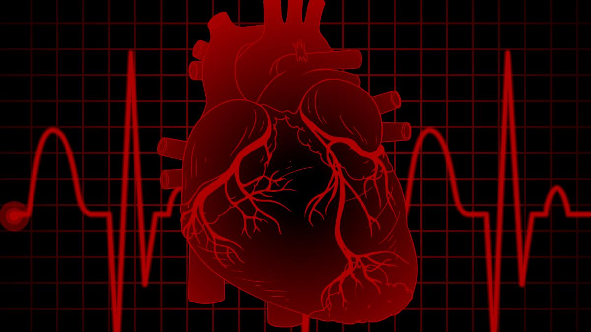avc-cardioembolic-simptome--cauze--cele-2-varste-de-granita-la-care-pot-aparea--stoicescu-cheagul-de-sange-e-aruncat-in-creier--daca-ai-trecut-de-varsta-asta--riscul-creste_57492500