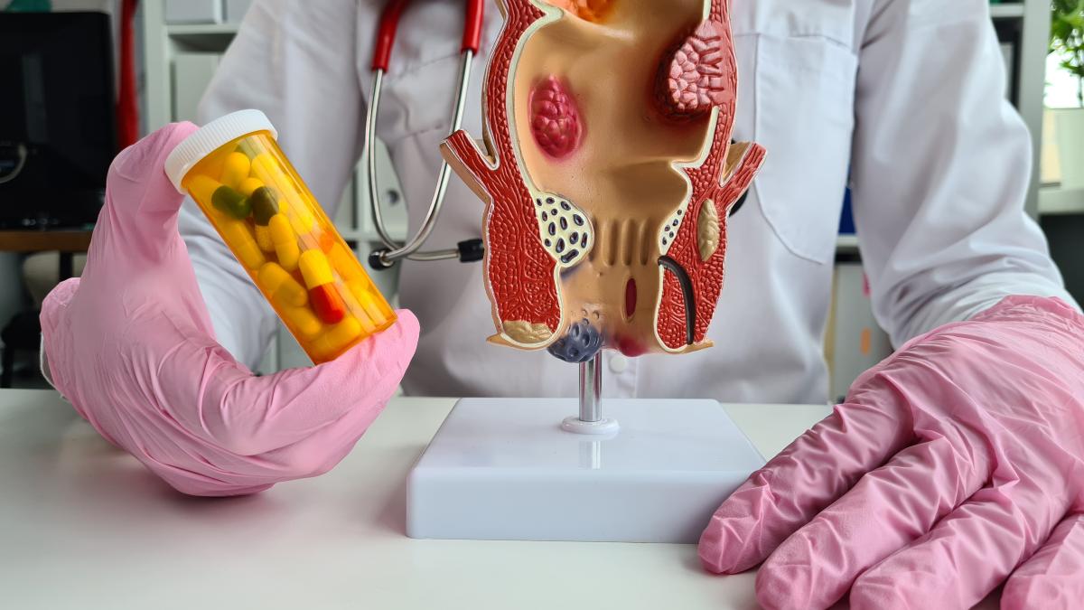 cancerul-rectal--tratament-prin-chirugie-robotica_08099800