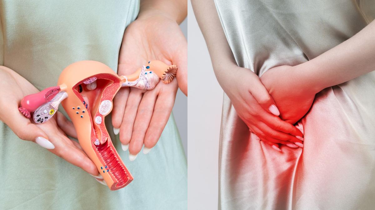 endometrioza-simptome-si-diagnostic--cum-stii-daca-ai-endometrioza--dijmarescu-apare-din-ce-in-ce-mai-mult-la-suprafata_24492900