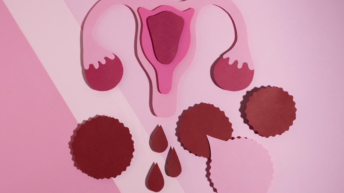 sindromul-ovarelor-polichistice-cauze--simptome--tratament--semnul-dat-de-menstruatie--herghelegiu-asta-e-semnalul-de-alarma-cu-care-vin-pacientele-la-ginecolog_96880000