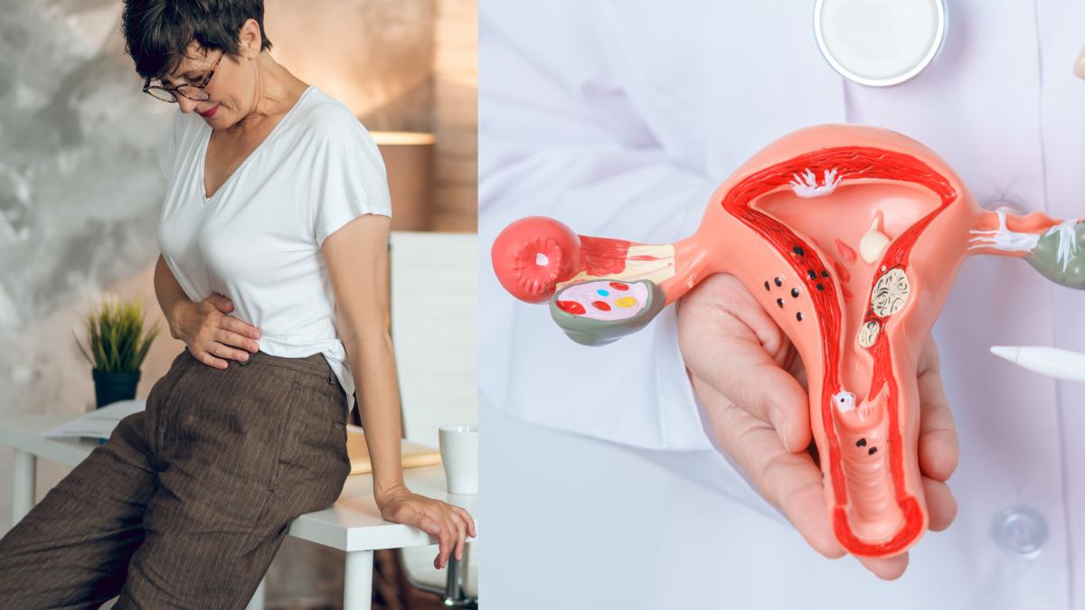 endometrioza_-tratament--medicamente-si-remedii-naturiste--ceaiul-si-alimentele-eficiente-care-reduc-simptomele_19936200