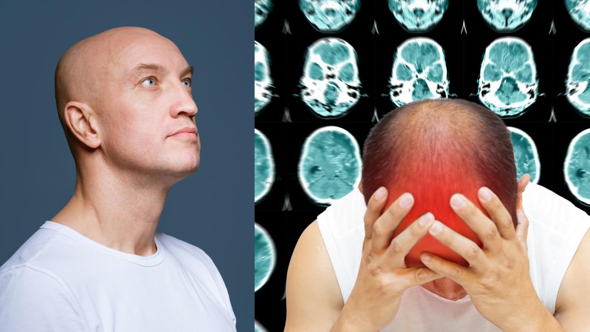 a-aflat-ca-are-cancer-pe-creier-in-stadiul-2--amorteala--semnul-inselator_-rmn-ul-a-declansat-semnale-de-alarma--spre-socul-meu--biopsia-a-aratat-ca-am-si-scleroza-multipla_67945900