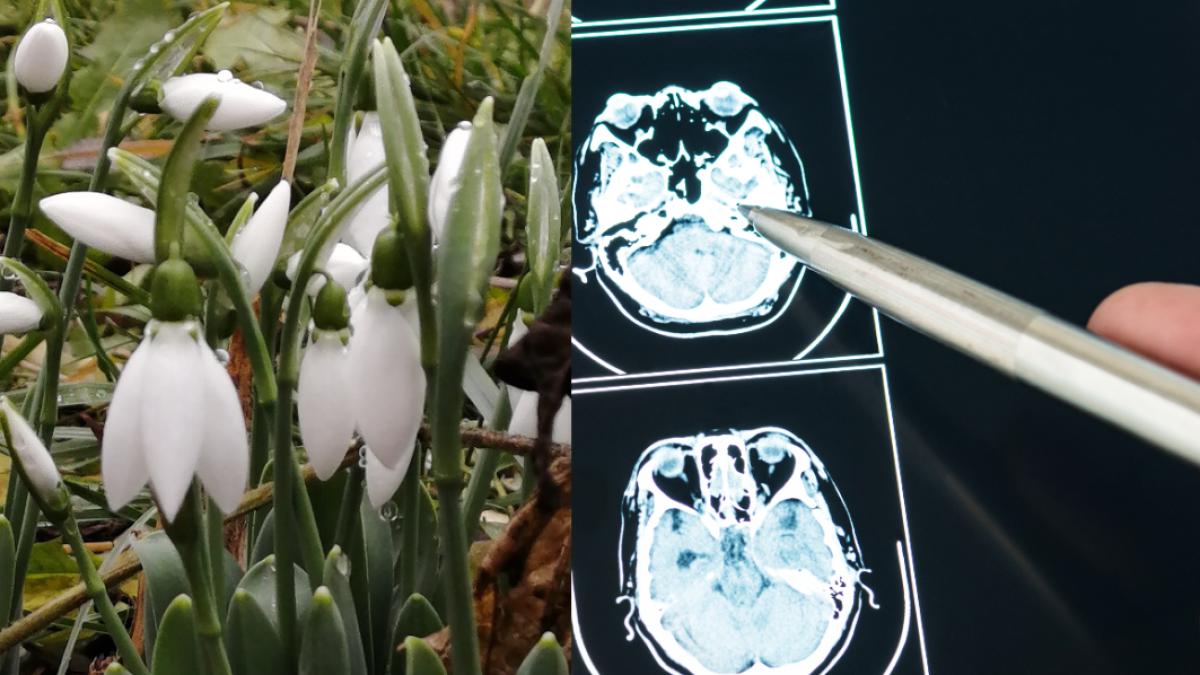 galantamina--un-compus-prezent-in-ghiocei--benefica-in-ameliorarea-bolii-alzheimer--ce-alte-proprietati-mai-are--dar-si-care-sunt-efectele-adverse_15391600