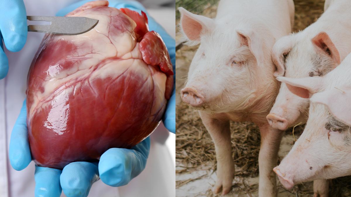 xenotransplantul-transgenic--transplant-de-la-porc--moldovan_-o-revolutie-in-medicina--modificam-genetic-animale--putem-construi-organe-in-animale_01928200