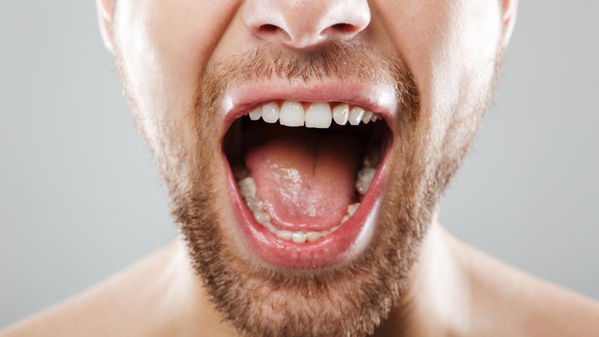 infectia-cu-hpv-si-igiena-orala-precara--factori-de-risc-pentru-cancerele-orl--se-poate-ajunge-chiar-si-la-pierderea-definitiva-a-vocii_64491100