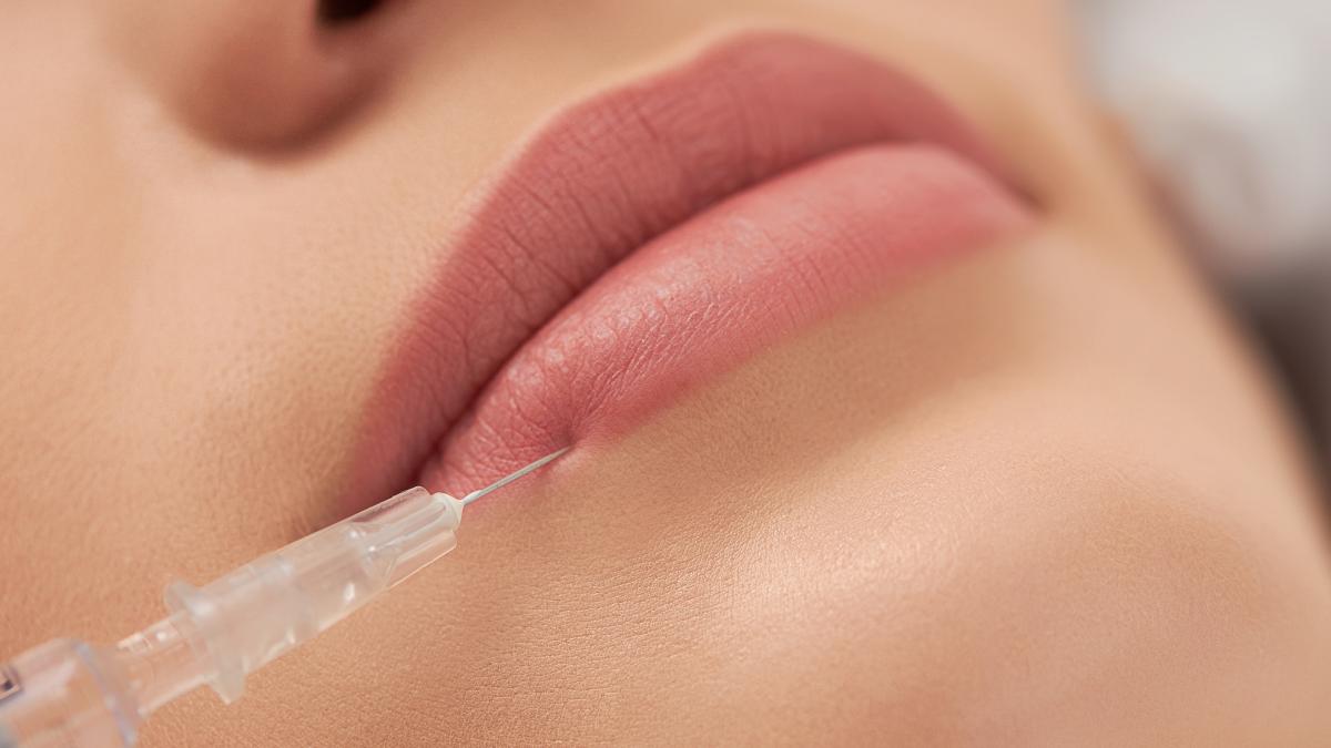 acidul-hialuronic--efect-asupra-buzelor_18719300