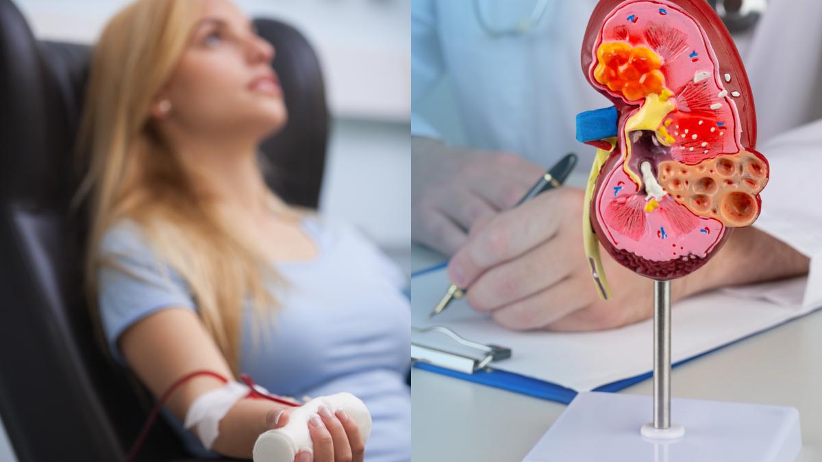 cele-doua-analize-care-iti-arata-daca-ai-o-boala-de-rinichi--alexandru-rafila_-boala-poate-fi-tratata-doar-prin-dializa-sau-transplant_53345700